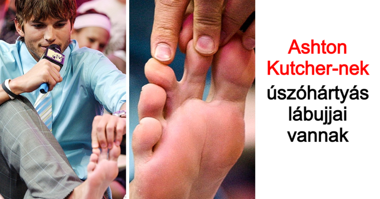 15 ember, akik különleges testvonásaikkal megrázzák a világot