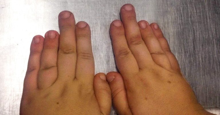 18 ember, akiknek a teste abszolút egyedülálló csoda