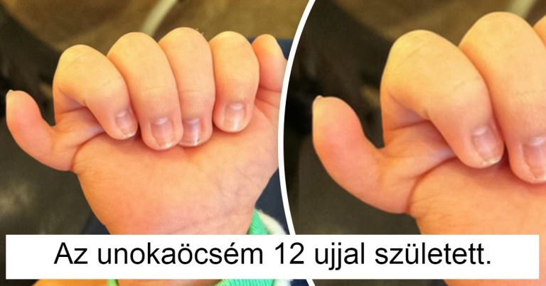 12 ember, akik egyediségükkel teszik fényesebbé a világot