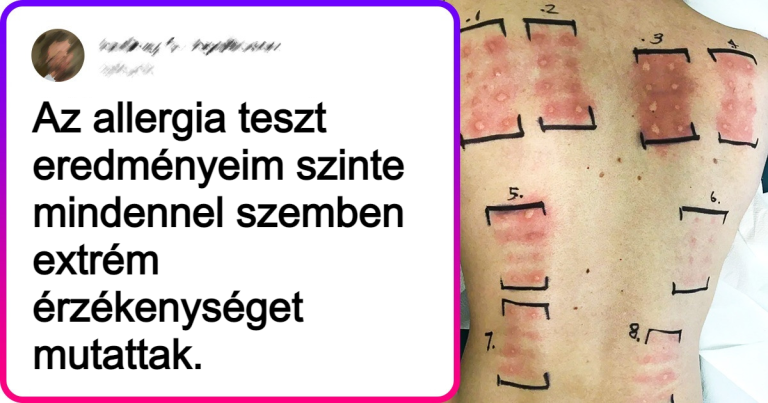 18 ember, akik csak normális életet akartak, de hatalmas meglepetést kaptak