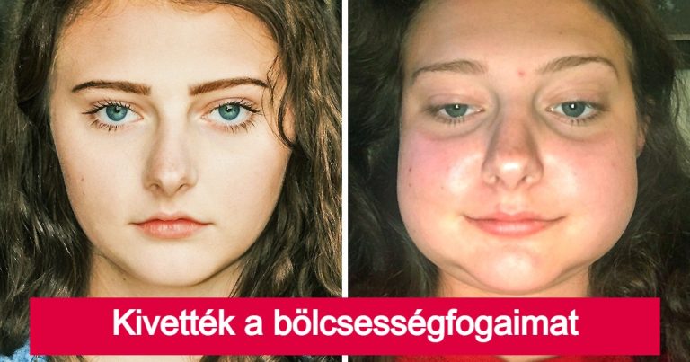 20 kép, ami bizonyítja, hogy néhány embernek rosszabb napja lehet, mint neked