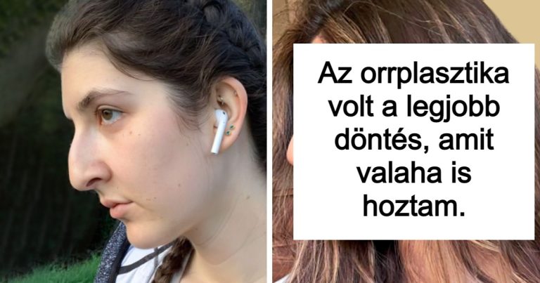 16 ember, akinek nem probléma, hogy elárulja, mennyire boldogok a plasztikai sebészetükkel