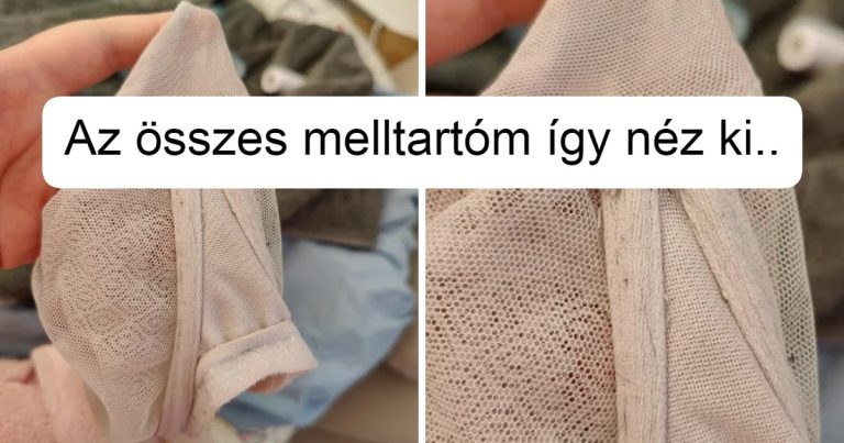 16 nő, akik összeszedtek némi bátorságot és megosztották a legnevetségesebb szépséghibáikat