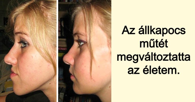 15 ember, akiknek motorja szupergyorsan működött, mert volt egy céljuk