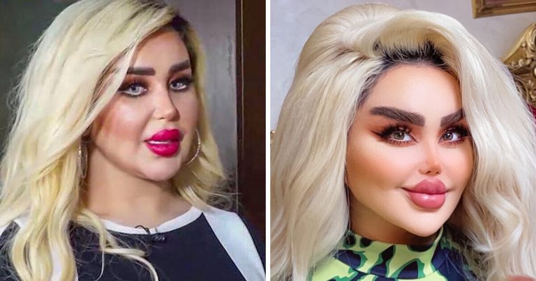 43 kozmetikai beavatkozáson estem át, hogy úgy nézzek ki, mint egy Barbie, de a kritikusok szerint úgy nézek ki, mint egy „zombi”