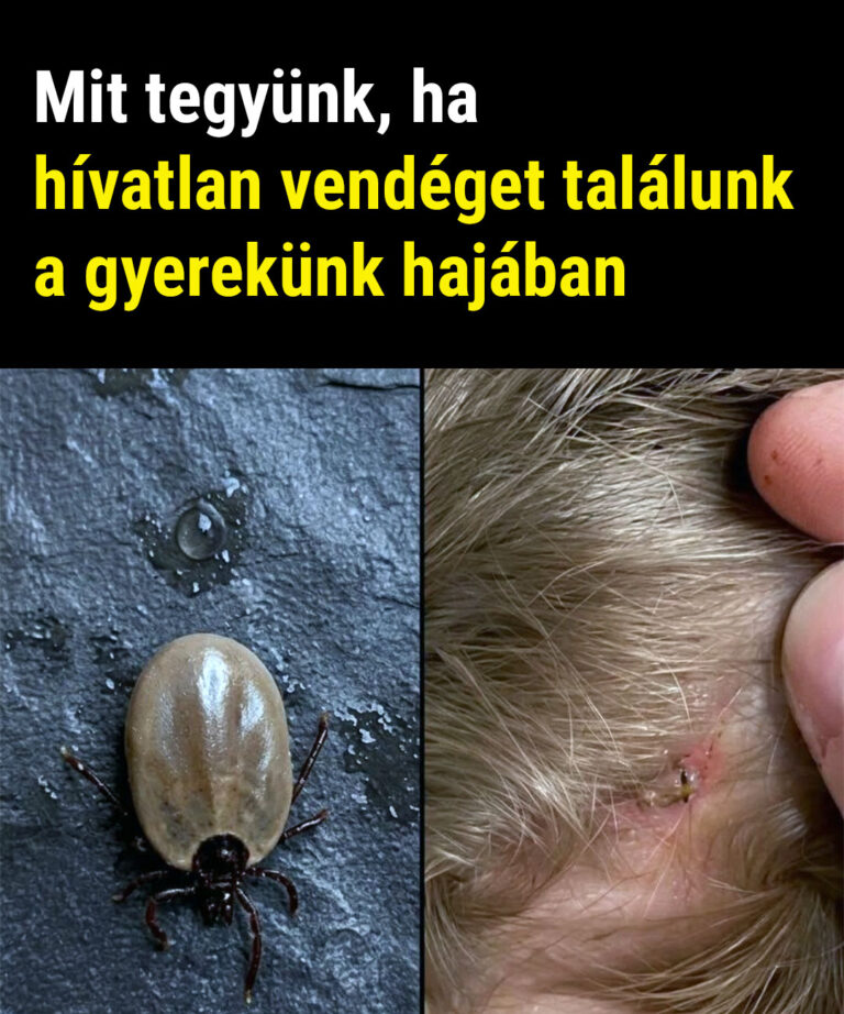 Hogyan maradj nyugodt, ha hívatlan vendéget találsz a gyereked hajában